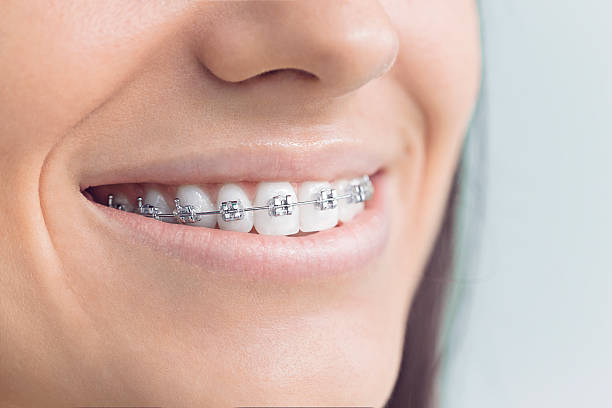 Best Dentures (Full and Partial)  in Fort Carson, CO